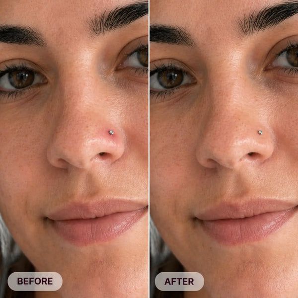 The Piercing Bump Story I Wish I Had Read Before Panicking Satori Cosmetics