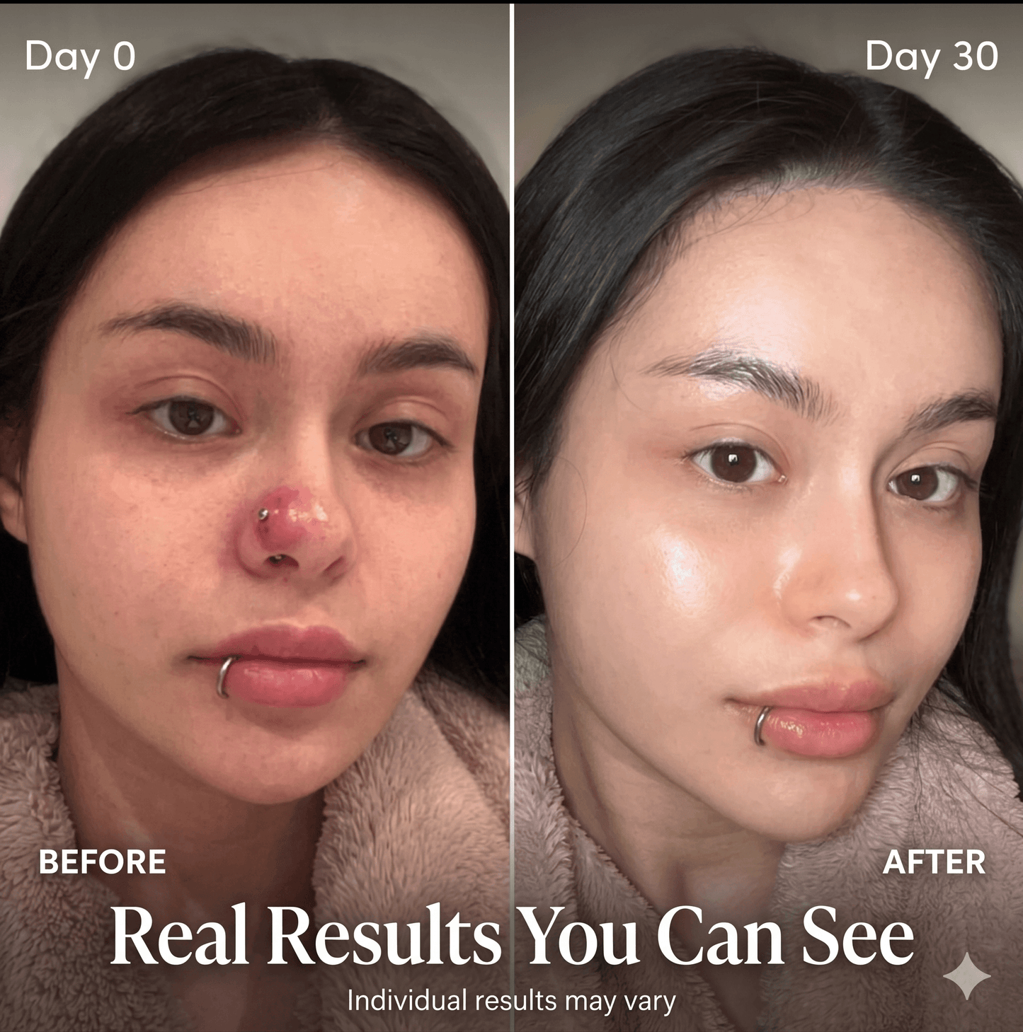 Critical Care Piercing Bump & Scar Reducer