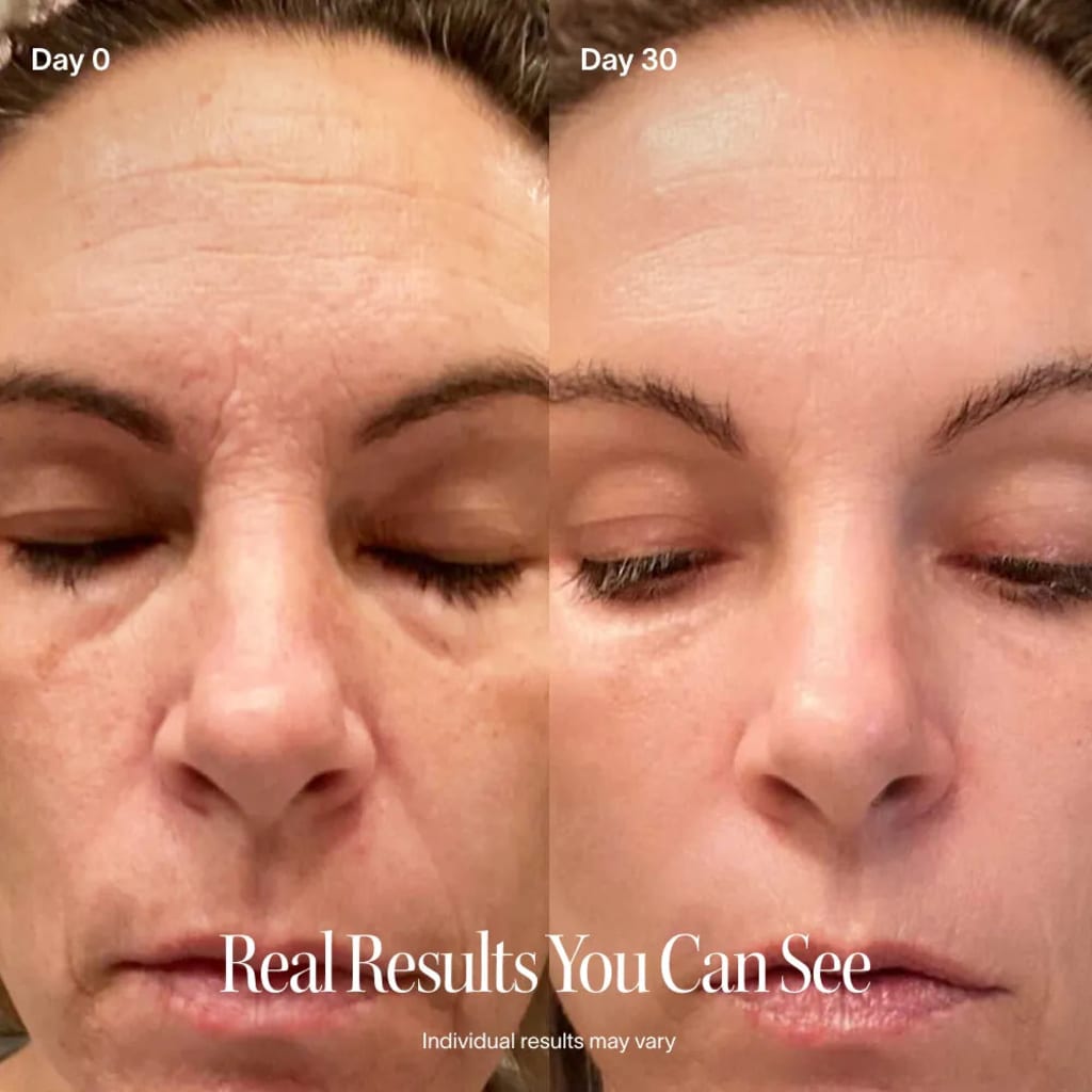 4-in-1 Skincare Wand