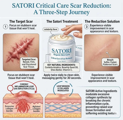 Critical Care Piercing Bump & Scar Reducer